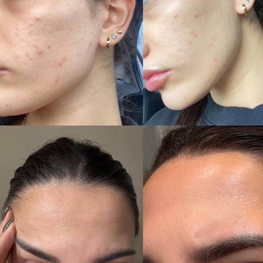 Maska LED na Twarz MK1 | Terapia Fotonowa do Domu | 7 Kolorów Światła | Zima Blue Cosmetics